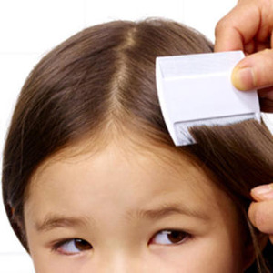 Lice treatment without chemicals